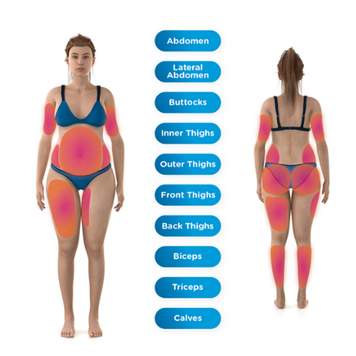 Emsculpt Neo Treatment Areas